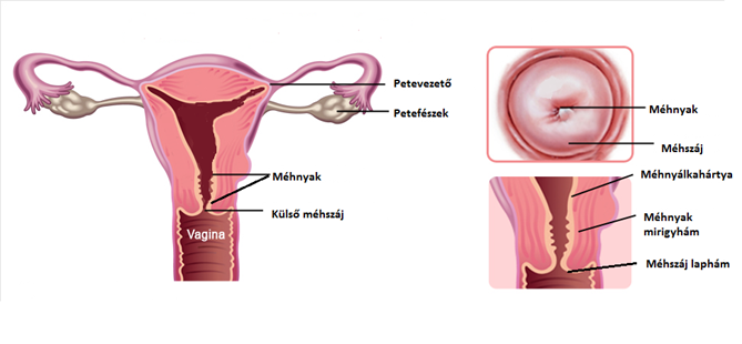 Ruptura cervicis uteri inveterata